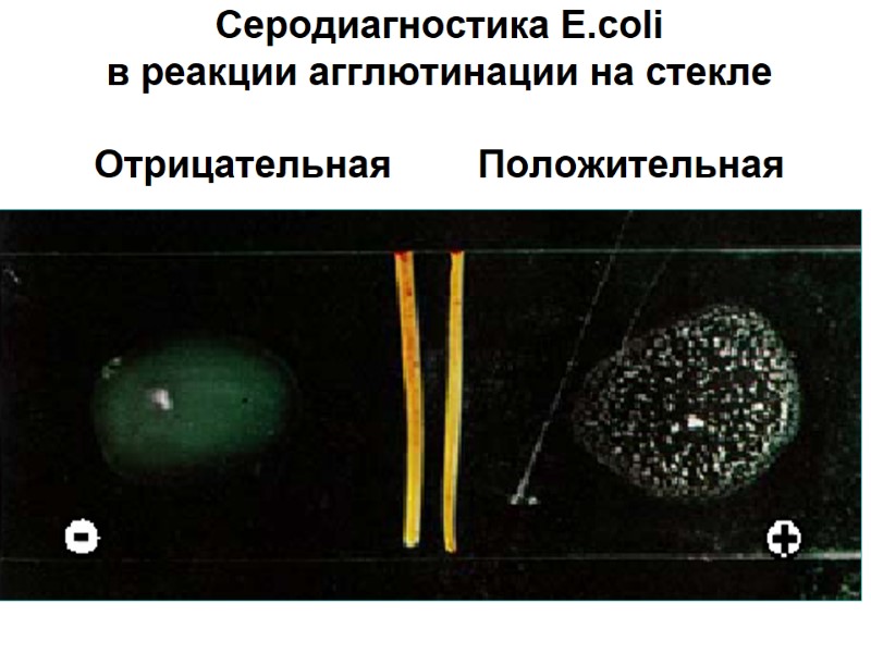 Серодиагностика E.coli  в реакции агглютинации на стекле  Отрицательная    